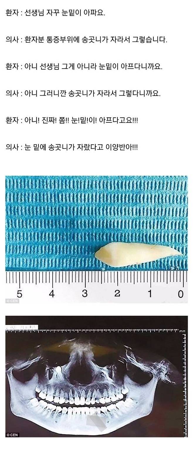 rrrrrr.jpg 눈이 아픈데 치과에 간 사람 ㄷㄷㄷㄷㄷㄷ.jpg