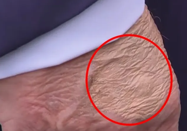 현지시간으로 15일 백악관에서 기자들과 만난 트럼프 미국 대통령의 손에서 짙은 화장 자국이 발견됐다. 데일리메일 제공