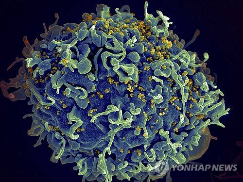 HIV Drug Approved 인체면역결핍바이러스(HIV, 노란색)의 공격을 받는 사람의 T세포(푸른색)의 전자현미경 이미지 [AP 연합뉴스 자료사진]