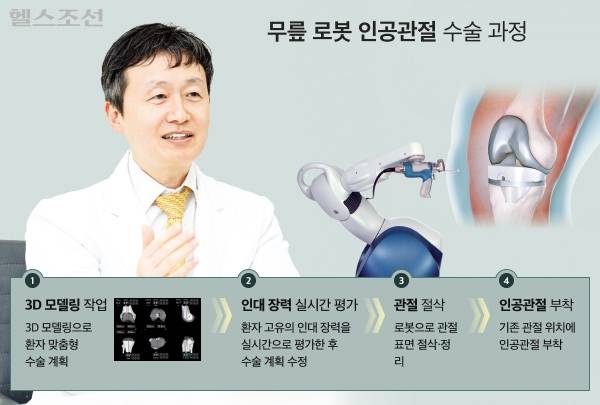 서울대병원 정형외과 한혁수 교수는 "로봇 인공관절 수술의 도입으로 환자마다 다른 정상 다리 정렬을 구현할 수 있게 되면서, 수술 만족도가 크게 높아졌다"고 말했다. 수술 전 로봇 시스템이 환자 맞춤형 계획을 세우면, 의사가 이를 바탕으로 로봇을 정밀하게 조작해 수술을 시행한다. /김지아 헬스조선 객원기자, 그래픽=김민선