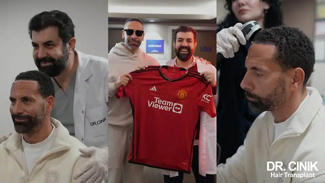 ニニック髪の移植クリニック博士は、元イングランドのサッカーチームリオ・フェルディナンドの手順を促進しました。 [사진 = 닥터 시닉 홈페이지]