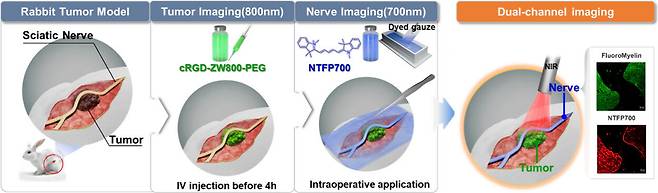 연구팀은 신경특이적 형광조영제와 기존 종양 타깃 조영제를 활용해 종양과 신경을 각각 다른 형광 물질로 구분해 동시에 확인할 수 있는 영상 기술을 구현했다
