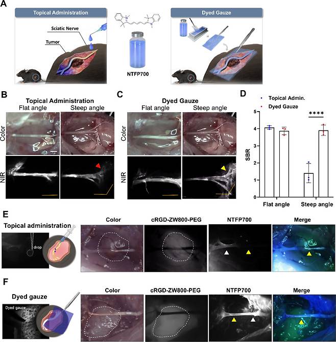 연구팀은 기존 도포방식에서 염색거즈방식을 활용했으며 균일정하고 안정적인 부위염색이 가능한 것을 확인했다.