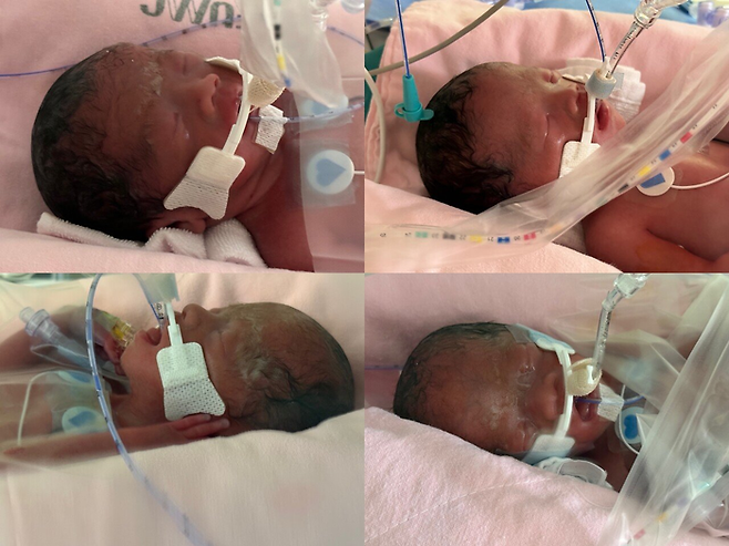 최근 태어난 네쌍둥이. [사진 = 에펨코리아]