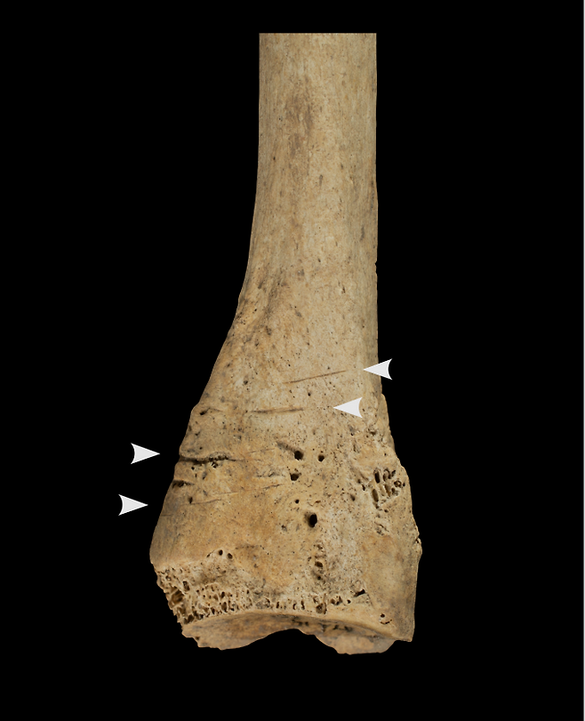 엘 미라도르 동굴에서 발견된 발뼈의 절단 흔적. IPHES-CERCA 제공