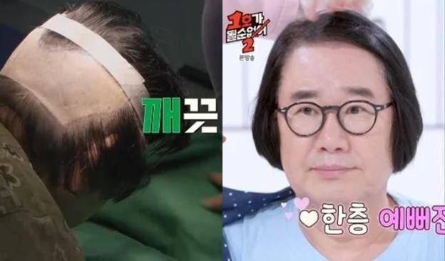 최양락이 모발이식술을 받았다. [사진=JTBC 예능 '1호가 될 순 없어2' 영상 캡처]