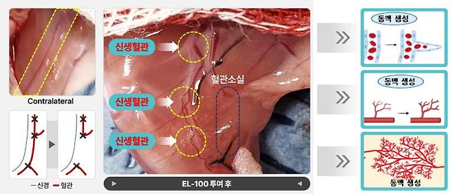 엘피스셀테라퓨틱스 중증하지허혈 치료 물질 'EL-100'의 동물실험 결과 그림. 혈류가 끊긴 쥐의 다리에 치료제를 투여하자, 썩어가던 조직에 새로운 혈관이 생기고 혈류와 혈류 속도가 개선됐다. 반면 치료제를 투여하지 않은 대조군은 다리 조직이 괴사해 절단했다./엘피스셀테라퓨틱스