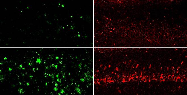 아밀로이드 베타 단백질을 회피하는 리튬 오로테이트(윗줄)로 생쥐에 투여한 결과, 탄산리튬(아랫줄)보다 아밀로이드 베타(왼쪽)와 타우(오른쪽) 단백질이 훨씬 많이 감소했다. Yankner Lab 제공
