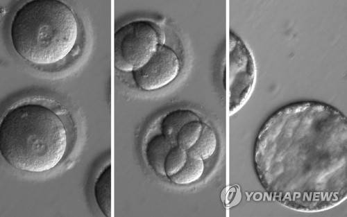 인간 배아 [EPA=연합뉴스 자료사진 제공]