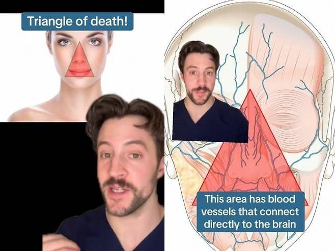 미국 피부과 전문의 마크 스트롬 박사가 얼굴 중앙에 있는 ‘죽음의 삼각형’ 부위에 관해 설명하는 모습. 틱톡 캡처