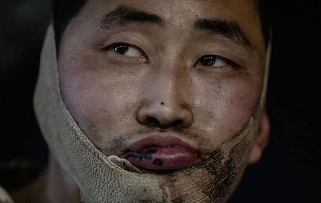 우크라이나 군에 포로로 잡힌 북한 군인. [엑스 캡처]