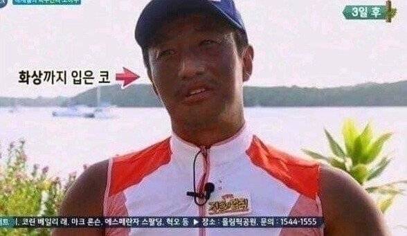 정글에서 썬크림 안바르면 생기는 일....jpg 정글에서 썬크림 안바르면 생기는 일....jpg