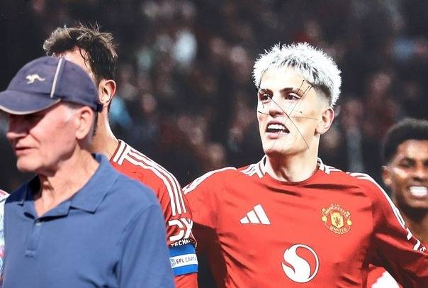 훼손된 가르나초의 얼굴 사진