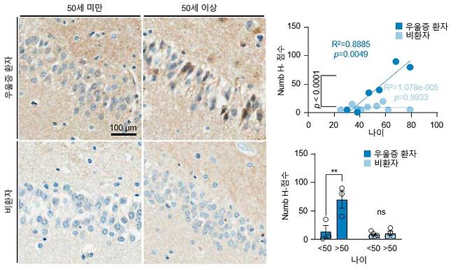 50세 미만 환자 및 비환자 그리고 50세 이상 고령 우울증 환자 및 비환자의 해마에서 Numb 단백질을 면역 염색 결과, 늙은 우울증 환자에서 Numb 단백질의 유의미한 증가가 관찰되었다. KAIST