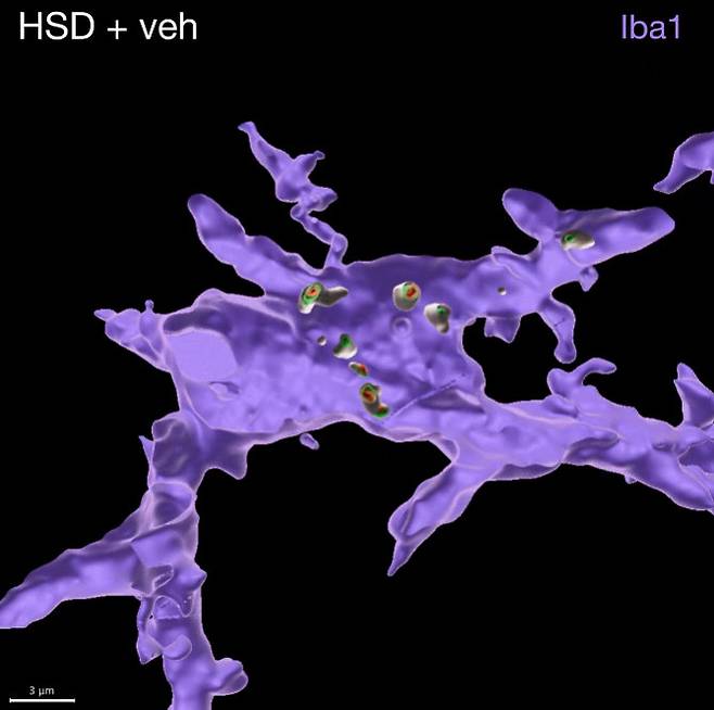 고염 식단 이후, 뇌 면역세포(보라색)가 다른 뇌세포의 조각(초록색과 주황색)을 포식하는 과정을 3D로 재구성한 모습. 맥길 대학교 제공.