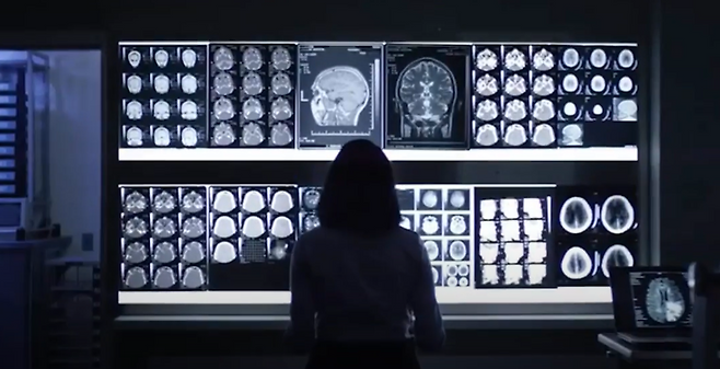 한 의료진이 IBM의 의료 AI ‘왓슨헬스’를 활용하는 모습 / IBM리서치 유튜브 영상 캡처