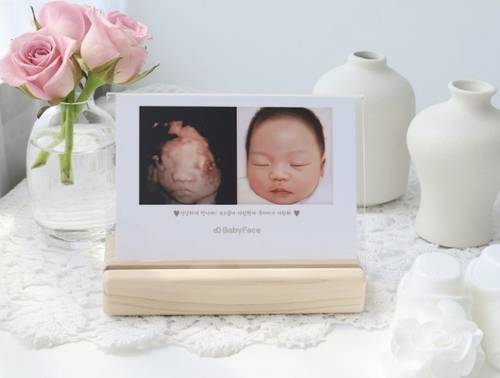 AI로 구현된 태아의 얼굴 [베이비페이스 제공. 재판매 및 DB 금지]