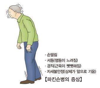 파킨슨병 [출처: 서울아산병원]