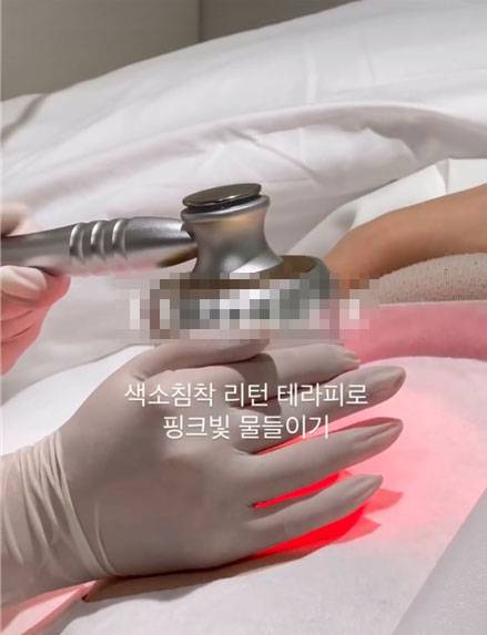 시술 장면/사진=소셜미디어 갈무리