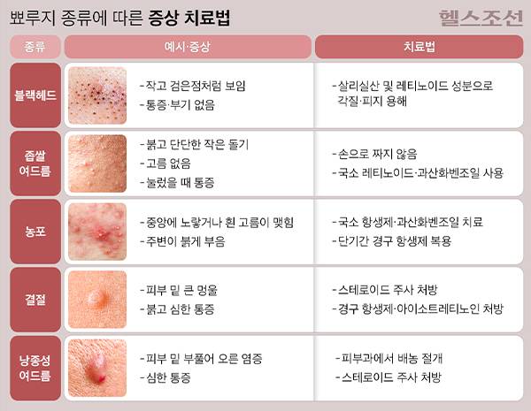 뾰루지는 종류에 따라 관리법이 다르고, 잘못 다루면 증상이 악화하거나 흉터로 남을 수 있다./그래픽=김민선
