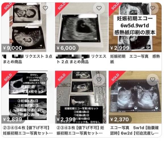 일본 중고물품 거래 플랫폼 메르카리에서 판매됐던 태아 초음파 사진들. X