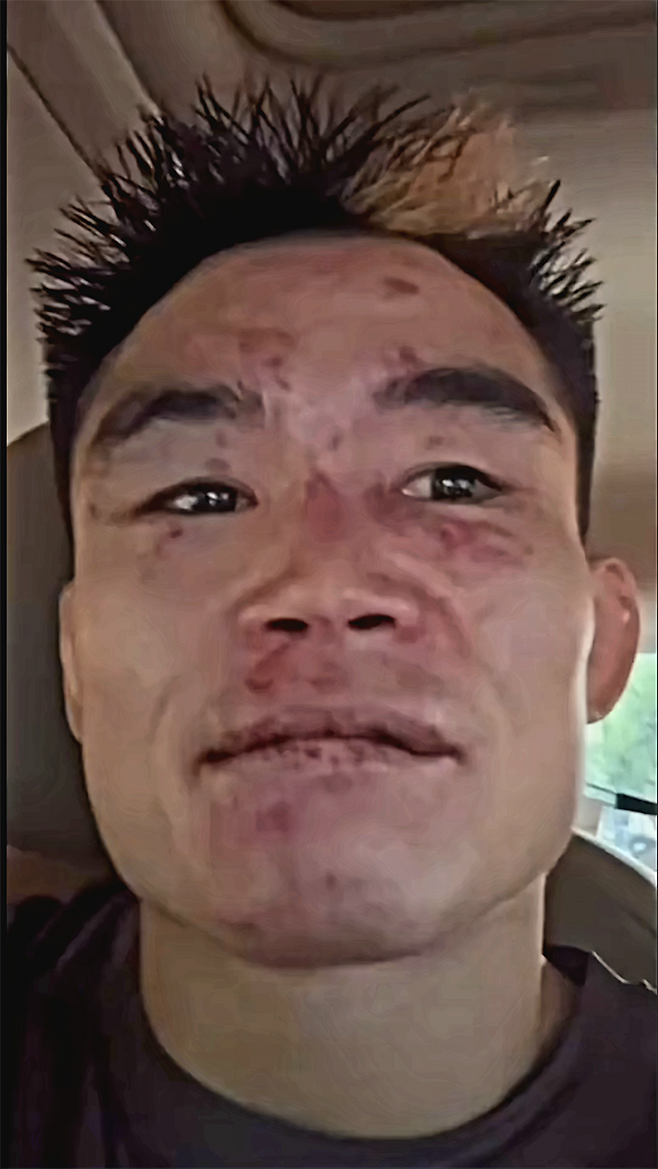 Road to UFC 시즌2 밴텀급 토너먼트 준우승자 샤오룽이 2025년 8월 중국 상하이다우타이에서 UFC 정규 파이터로 데뷔 2연승이 좌절된 후 호텔로 이동하며 소감을 말하고 있다. 사진=TKO