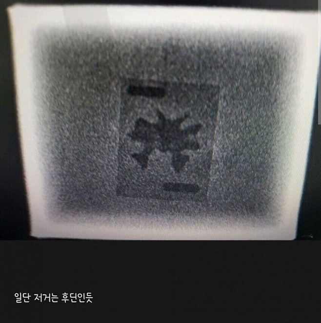 image.png 남편이 방사선사라 좋은점.jpg