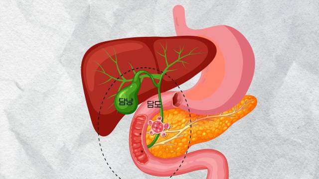 담도암은 담즙이 흐르는 통로인 담도와 담즙이 머무는 담낭에 생기는 암으로, 초록색 부분에 해당한다. /서울경제TV '지금, 명의' 캡처