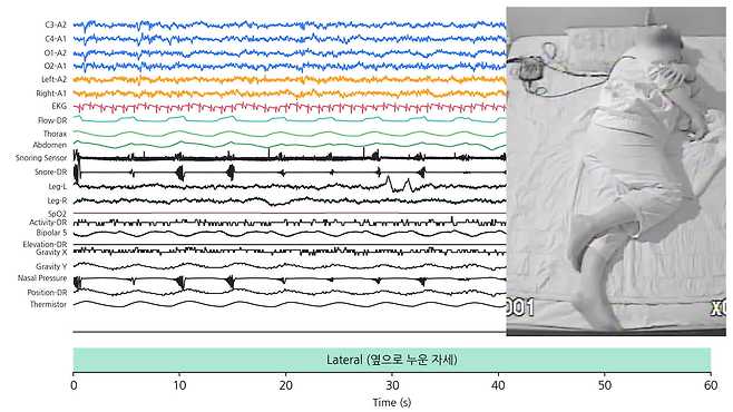 자료 제공: 서울대병원