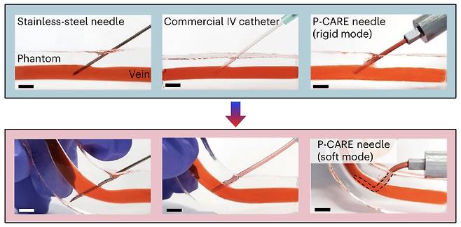 스테인리스스틸 주삿바늘(왼쪽)과 달리 가변강성(P-CARE, 오른쪽) 주삿바늘은 혈관에 삽입되면 체온에 의해 부드러워져 환자가 팔을 접더라도 바늘이 혈관을 뚫고 주변 조직을 손상할 우려가 없다. 또한, 혈관에서 제거된 가변강성 주삿바늘은 재사용이 불가능하다. 정재웅 교수 제공