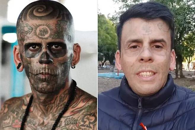 20년간 170개 이상의 문신을 새긴 남성이 돌연 제거에 나섰다. 문신 제거에는 오랜 시간이 걸릴 뿐만 아니라 통증도 수반된다. 고열 자극이 반복돼 피부가 따끔거리거나 불에 덴 듯한 통증이 나타난다. [사진=인스타그램 'leandrodesouzabless']