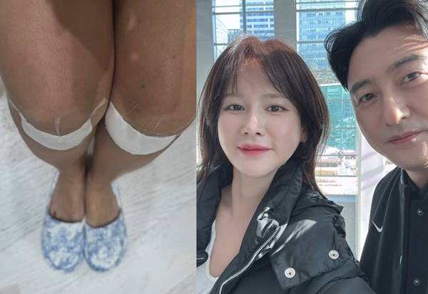 사진=이혜원 SNS