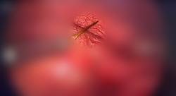 29세 사우디아라비아 남성의 회장벽에서 튀어나온 이쑤시개./사진=‘외과수술사례보고서저널’ 캡처