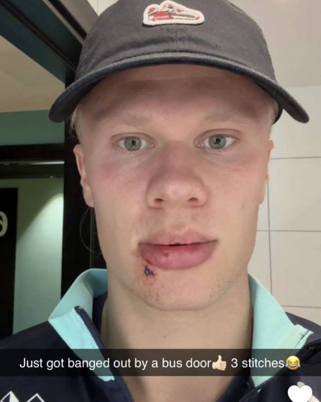 사진=센트레 데빌스