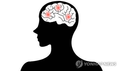 뇌졸중 뇌출혈(일러스트) [연합뉴스 자료]