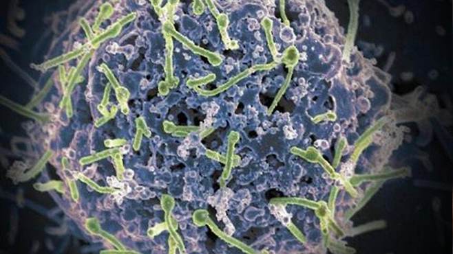 에볼라 바이러스 전자현미경 이미지. 미 국립 알레르기 감염질환 연구소 제공