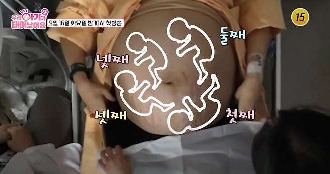 의료진만 20여명이 넘게 투입된 네쌍둥이의 출산 현장이 공개됐다. 유튜브 채널 '우리 아기가 또 태어났어요' 영상 캡처