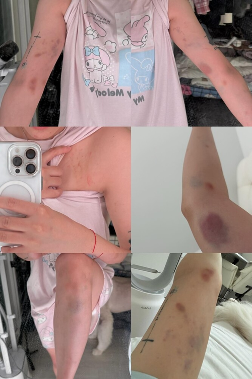 대만 여성 유튜버 A씨가 자신의 소셜네트워크서비스(SNS)에 올린 사진. 스레드 갈무리