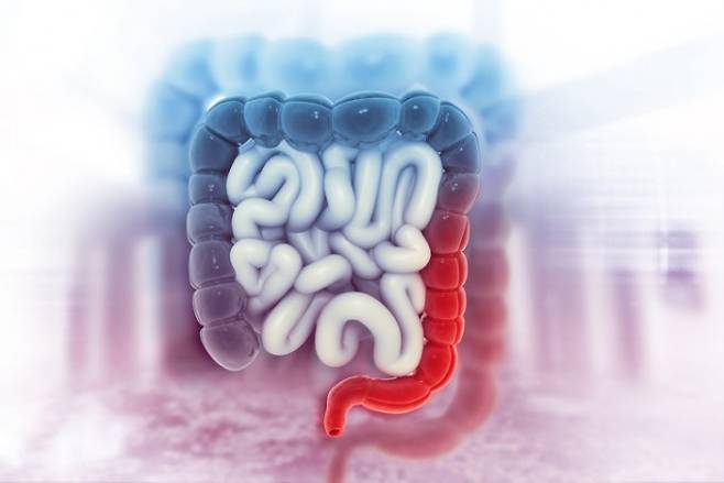 아스피린이 일부 대장암 환자의 재발 위험을 낮추는 것으로 확인됐다. 게티이미지뱅크 제공.