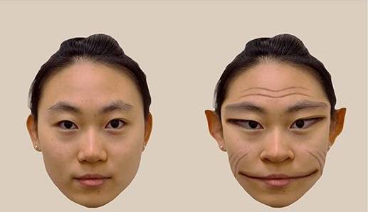 정상적인 시야와 얼굴변형시증 환자의 시야/사진=The Lancet