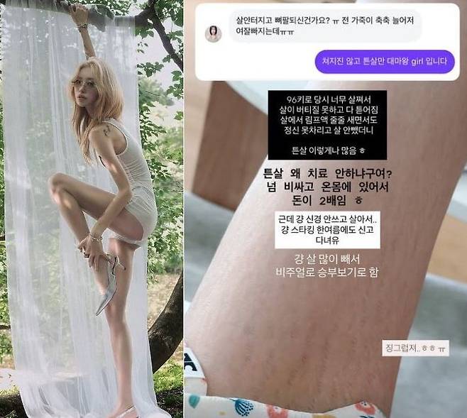최준희가 튼살을 공개했다. 사진=최준희 인스타그램