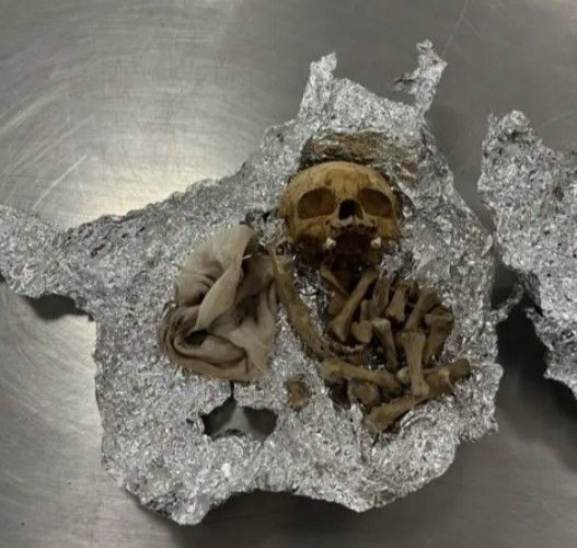 미국에서 알류미늄 포일에 해골을 숨겨 입국하려던 한 여행객이 세관 직원에 의해 적발되는 사건이 발생했다. 뉴욕포스트 뉴시스