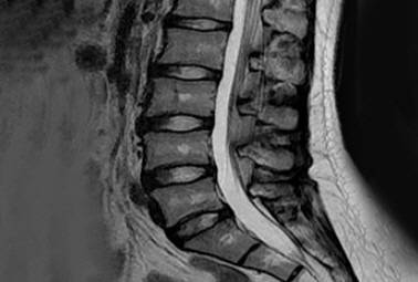 ▲ 정상 디스크_화이트 디스크,