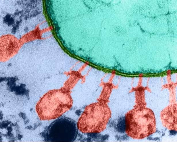대장균 세포를 둘러싼 바이러스. 분홍 부분이 바이러스다. /사이언스 포토 라이브러리