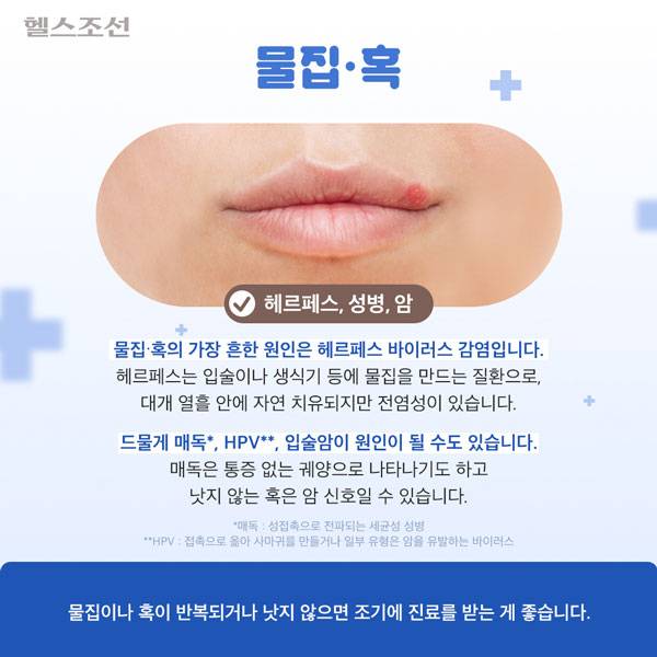 사진=헬스조선DB