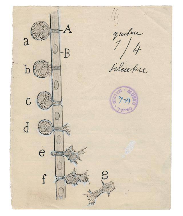 카할이 그린 혈관을 뚫고 이동하는 백혈구의 모습. ⓒCSIC