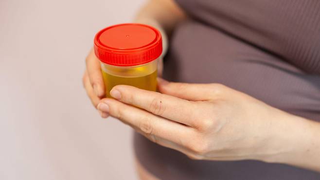 요로 감염이 의심된다면 소변 샘플을 채취해 검사할 수도 있다