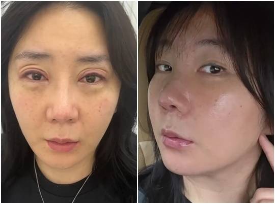 허안나 소셜 미디어