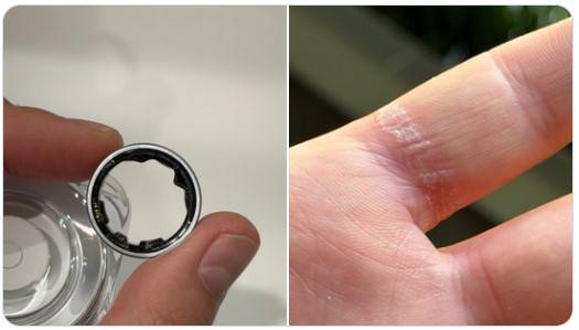 [다니엘 로타르 X 캡처]