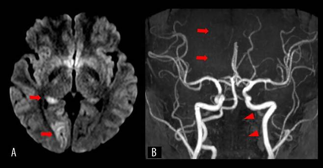 [서울=뉴시스] (사진='미국 사례 보고 저널' 캡처) *재판매 및 DB 금지